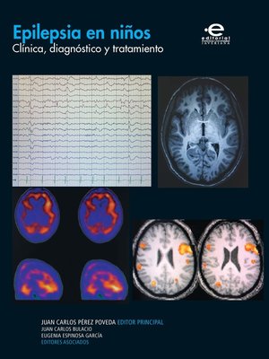 cover image of Epilepsia en niños